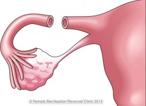 Sterilization 2